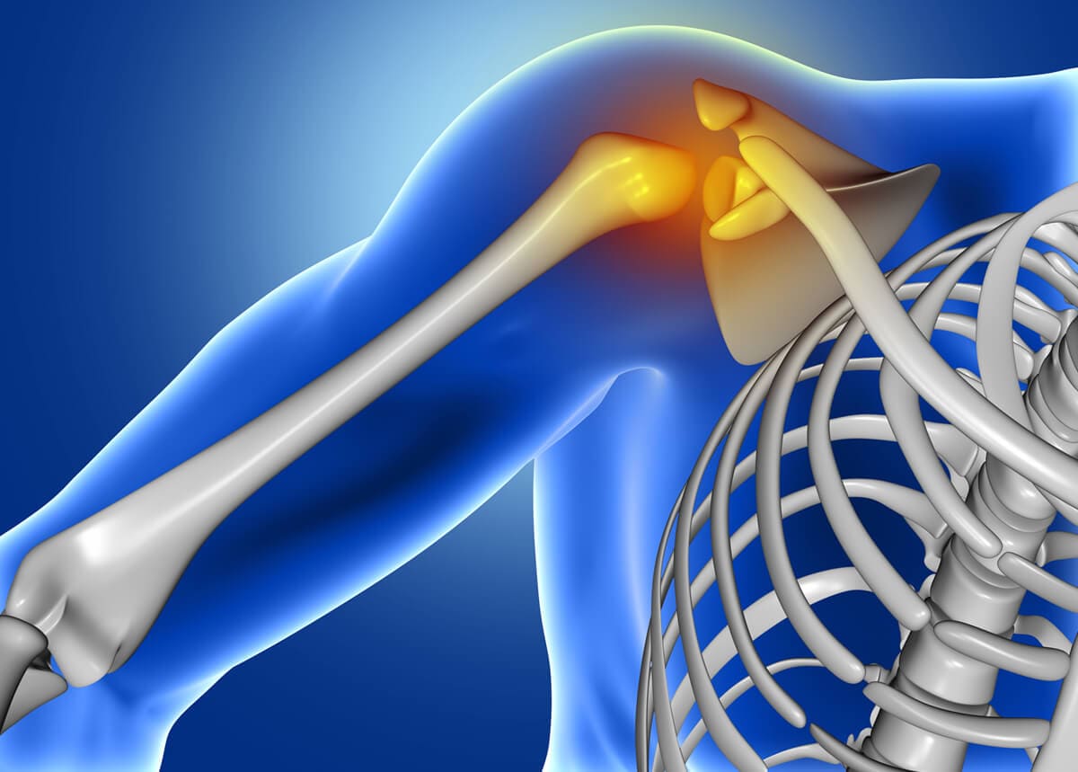 Shoulder Arthroscopy